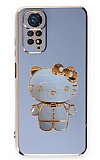 Eiroo Aynal Kitty Xiaomi Redmi Note 11S Standl Mavi Silikon Klf