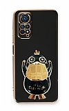 Eiroo rdek Xiaomi Redmi Note 11S Standl Siyah Silikon Klf
