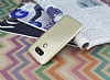 LG G5 Mat Gold Silikon Klf - Resim: 2