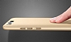Xiaomi Mi 6 Tam Kenar Koruma Lacivert Rubber Klf - Resim: 1