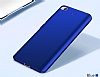 Xiaomi Mi 5s Tam Kenar Koruma Lacivert Rubber Klf - Resim: 4