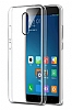 Xiaomi Redmi Pro effaf Kristal Klf - Resim: 1