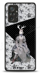 Dafoni Art Xiaomi Redmi Note 10 Pro Prom Deer Kılıf - Dafoni
