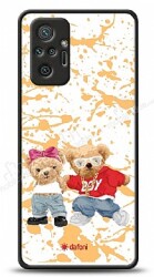 Dafoni Art Xiaomi Redmi Note 10 Pro Style Couple Teddy Kılıf - Dafoni
