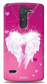 LG G3 Stylus Angel Klf
