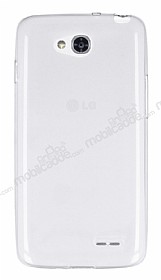 LG L90 Ultra nce effaf Silikon Klf