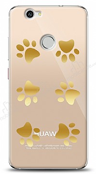 Huawei Nova Gold Patiler Klf