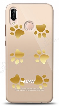 Huawei P20 Lite Gold Patiler Klf