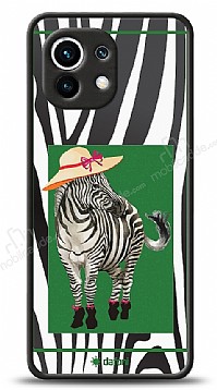 Dafoni Art Xiaomi Mi 11 Fancy Zebra Kılıf