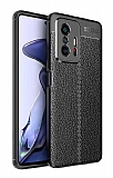 Dafoni Liquid Shield Xiaomi 11T Pro Ultra Koruma Siyah Klf