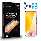 Dafoni Xiaomi 12 Lite Nano Premium Ekran Koruyucu