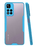 Eiroo Painted Xiaomi Redmi Note 11 Pro Mavi Silikon Klf