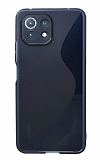 Eiroo S Line Xiaomi Mi 11 Lite / Xiaomi Mi 11 Lite 5G Mavi Silikon Kılıf