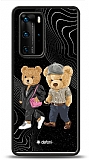 Dafoni Art Huawei P40 Compatible Couple Teddy Kılıf