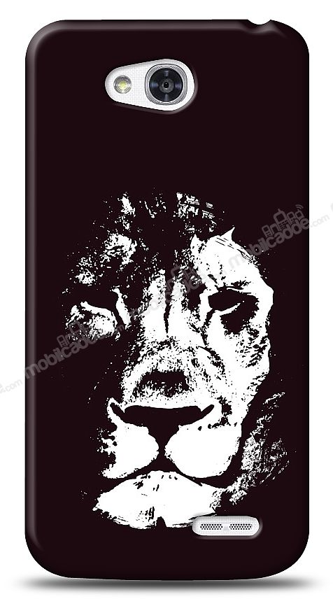 LG L70 Black Lion Kılıf