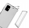 Dafoni Clear Hard Samsung Galaxy A31 Ultra Koruma Klf - Resim: 1