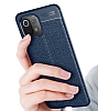 Dafoni Liquid Shield Premium Xiaomi Mi 11 Lite Siyah Silikon Klf - Resim: 3