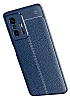 Dafoni Liquid Shield Xiaomi 11T Ultra Koruma Siyah Klf - Resim 1