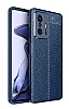 Dafoni Liquid Shield Xiaomi 11T Ultra Koruma Lacivert Klf