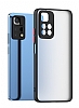 Dafoni Union Xiaomi Redmi Note 11 Pro 5G Ultra Koruma Siyah Klf - Resim: 3