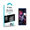 Eiroo Huawei Mate 10 Pro Tempered Glass Cam Ekran Koruyucu