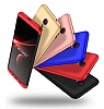 Eiroo Protect Fit Xiaomi Redmi 5 Plus 360 Derece Koruma Siyah Rubber Klf - Resim: 4