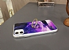 Eiroo Starry iPhone XS Max Ananas Silikon Klf - Resim: 3