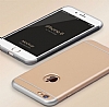 Eiroo Trio Fit iPhone 6 Plus / 6S Plus 3 1 Arada Gold Rubber Klf - Resim 3
