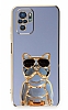 Eiroo Xiaomi Redmi Note 10 Bulldog Standl Mavi Silikon Klf