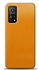 Dafoni Xiaomi Mi 10T 5G Metalik Parlak Grnml Sar Telefon Kaplama