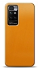 Dafoni Xiaomi Redmi 10 Metalik Parlak Grnml Sar Telefon Kaplama