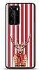 Dafoni Art Huawei P40 Pro Scarfed Deer Klf