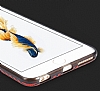 Totu Design Karbon iPhone 6 / 6S Siyah Silikon Klf - Resim: 5