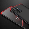 Zore GKK Ays Xiaomi Redmi Note 10 Pro 360 Derece Koruma Siyah Rubber Klf - Resim: 6