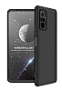 Zore GKK Ays Xiaomi Redmi Note 10 Pro 360 Derece Koruma Siyah Rubber Klf